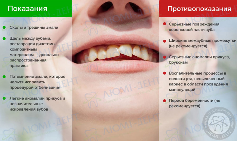 Методы реставрации зубов фото ЛюмиДент