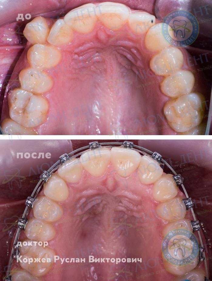 Что делает стоматолог ортодонт фото Люми-Дент