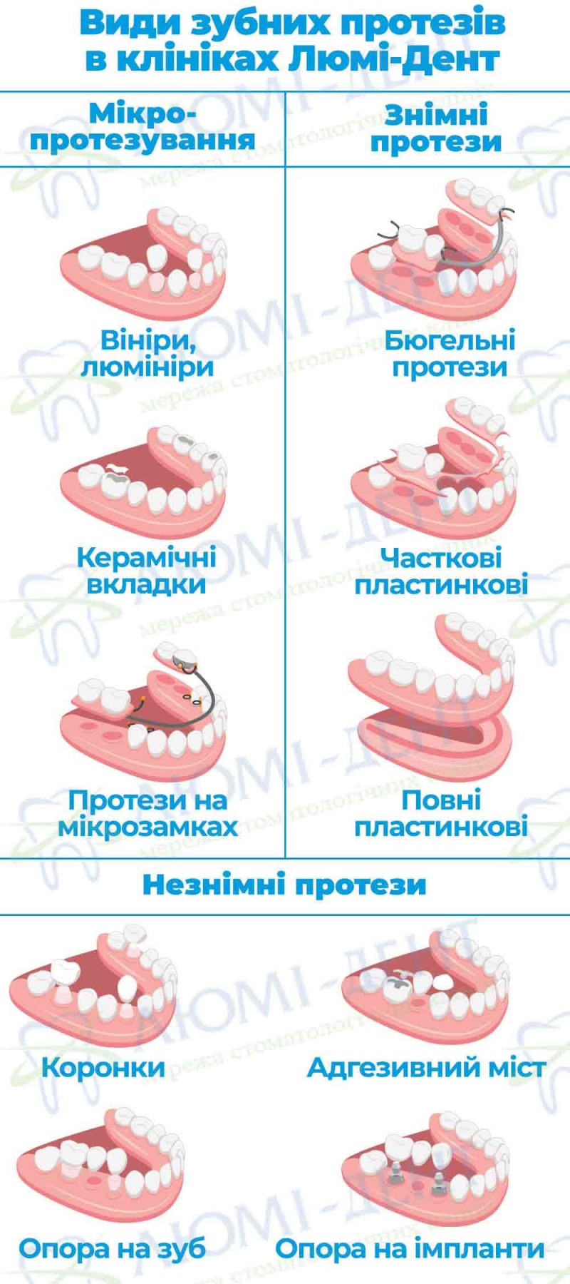Знімний частковий протез на один зуб фото Люмі-Дент