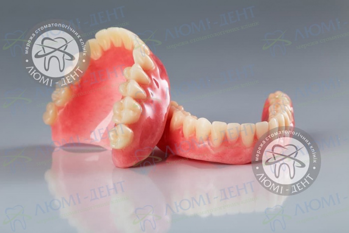 Знімний іммедіат протез на один зуб фото Люмі-Дент