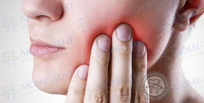 скільки болить зуб після видалення фото Люмі-Дент