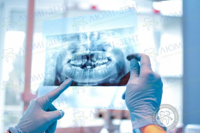 Як роблять панорамний знімок зубів фото ЛюміДент