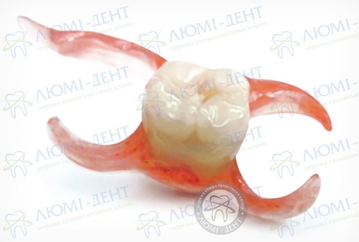 нейлонові зубні протези ціна фото Люмі-Дент