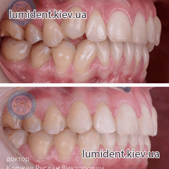 Хороший детский Ортодонт стоматолог фото Киев Люмидент