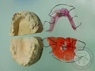 Пластинка на зуби ціна фото Люмі-Дент