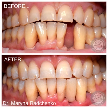 Примеры работ доктора Врач стоматолог-терапевт Радченко Марина Витальевна