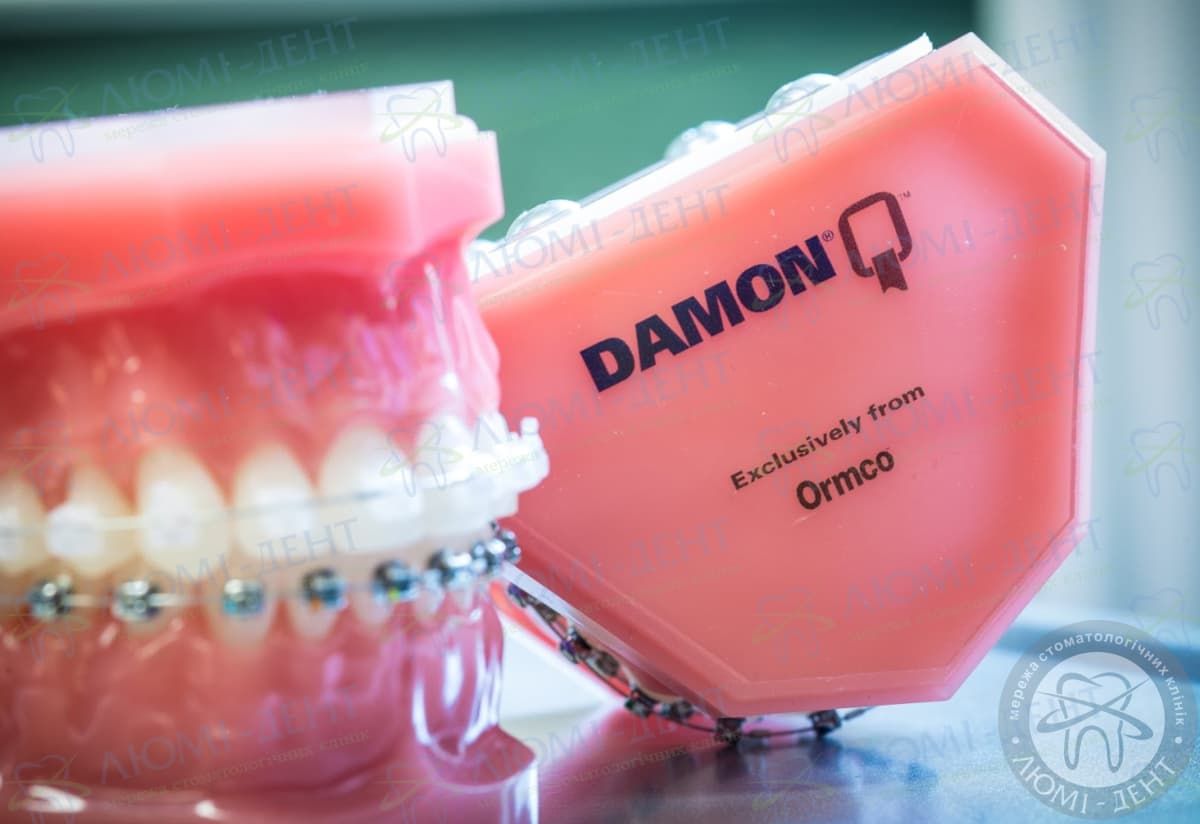 Ormco брекеты🦷Ормко🦷Киев ЛюмиДент