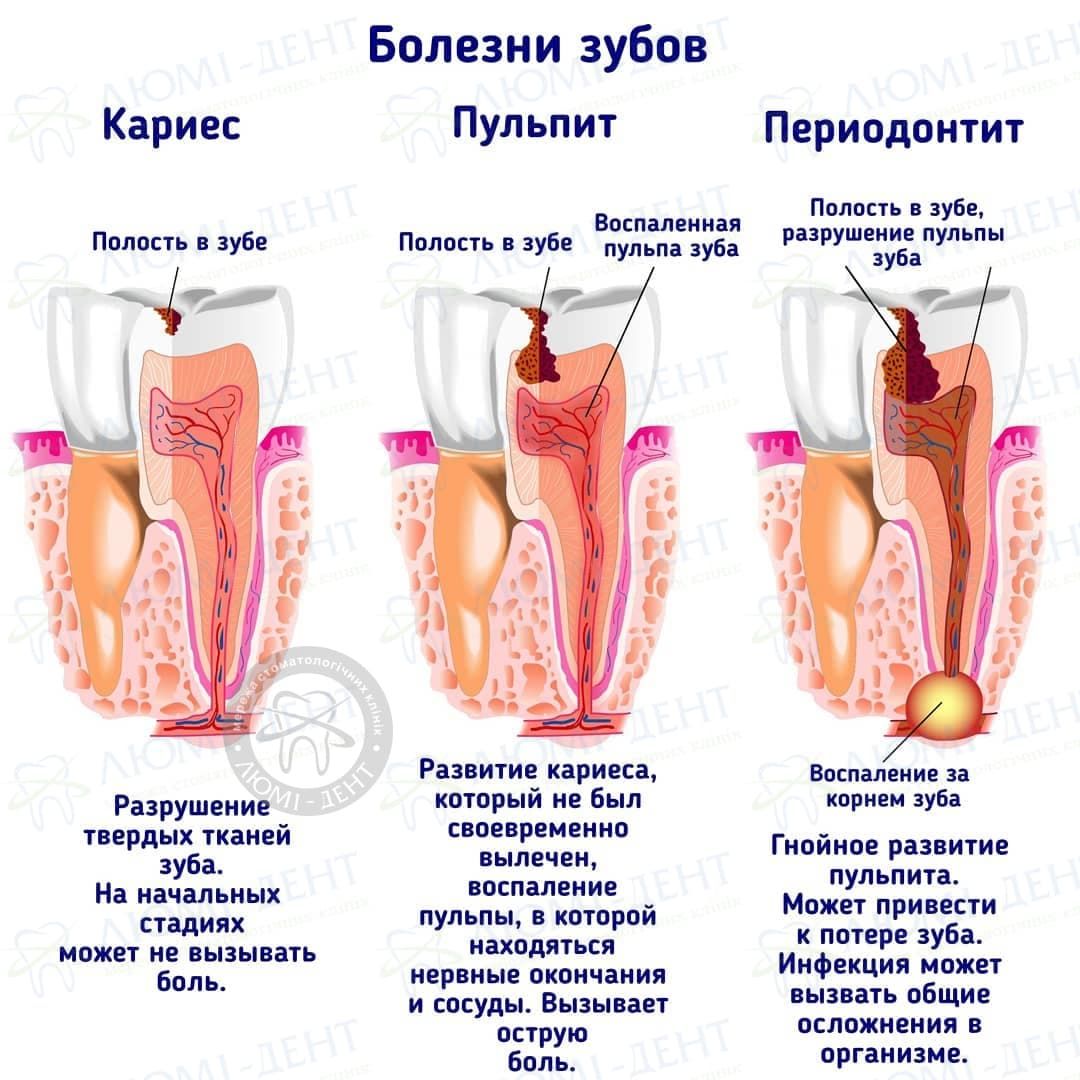 Почему Болит Фото