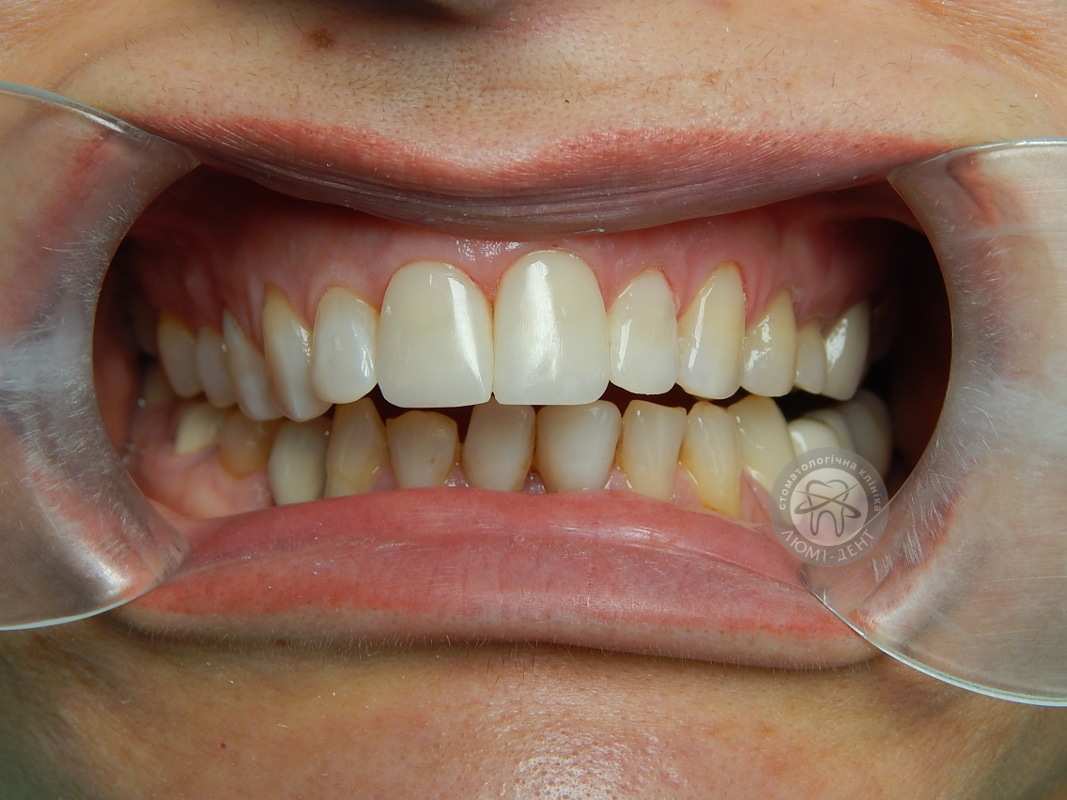 pictures Как сделать глазурь для торта изображения photo Как сделать глазурь для торта изображения
