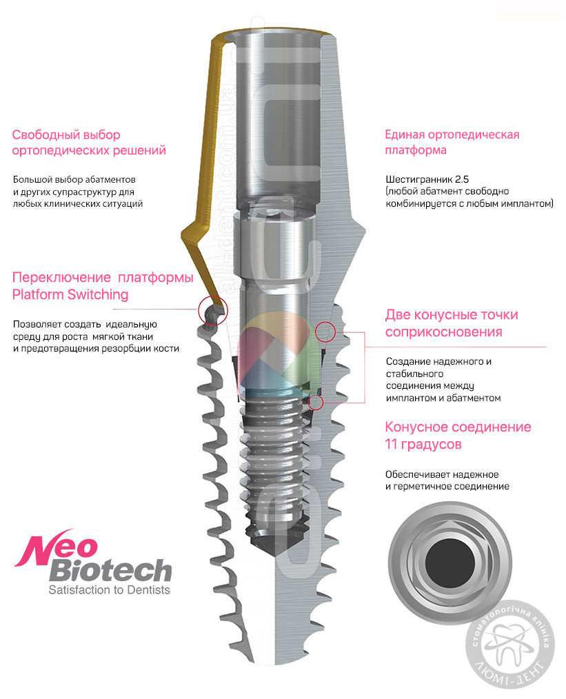 Структура импланта neobiotech Преимущества имплантов