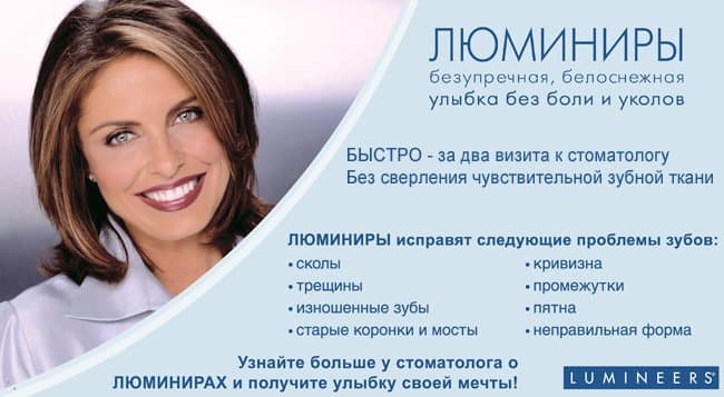 Люминиры люминиры киев