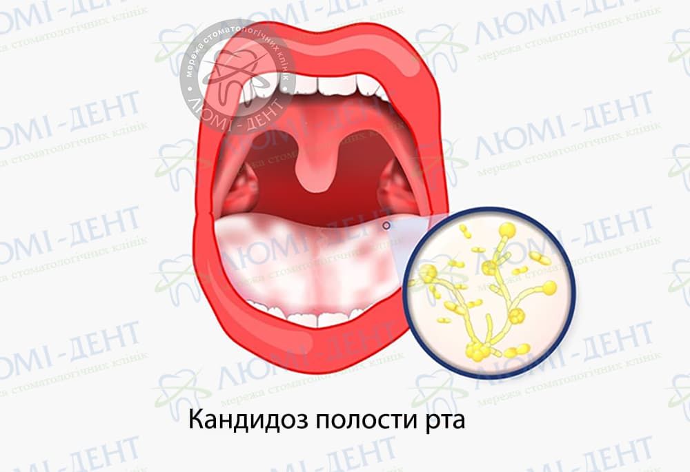 Використання рослинних трав і спецій