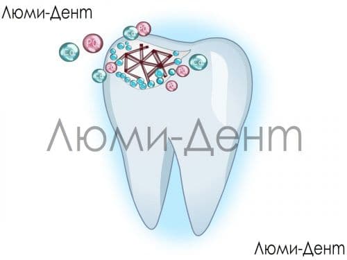 Укрепление лечение имплантация эмали зубов Люми-Дент 