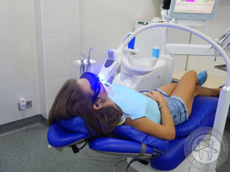 Процесс фотоотбеливания Magic Smile Система отбеливания зубов