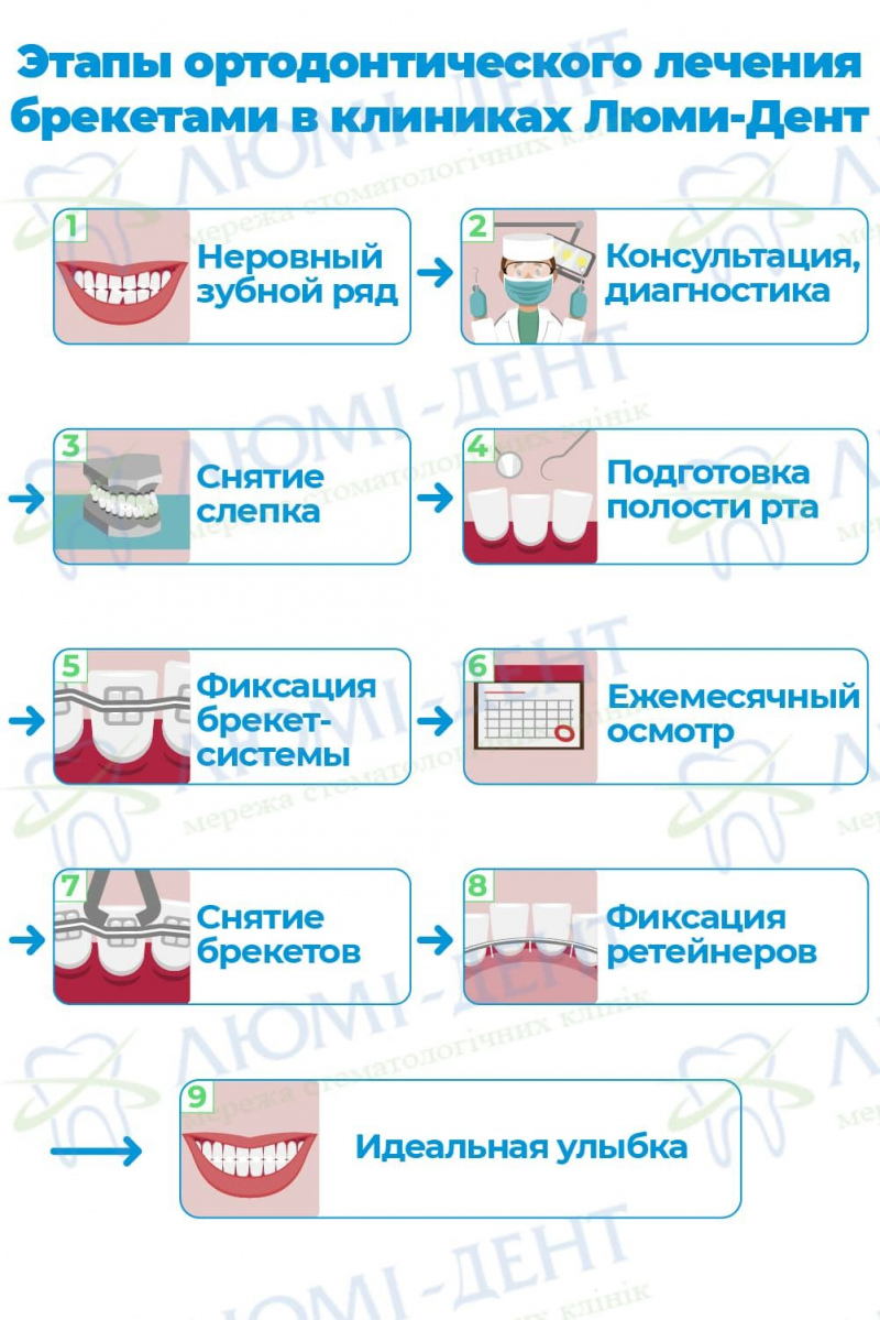 Больно ли снимать брекеты отзывы фото Люми-Дент