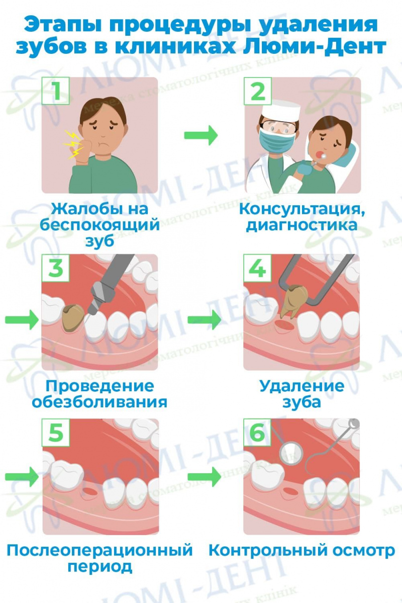 Больно ли удалять зуб с уколом фото Люми-Дент