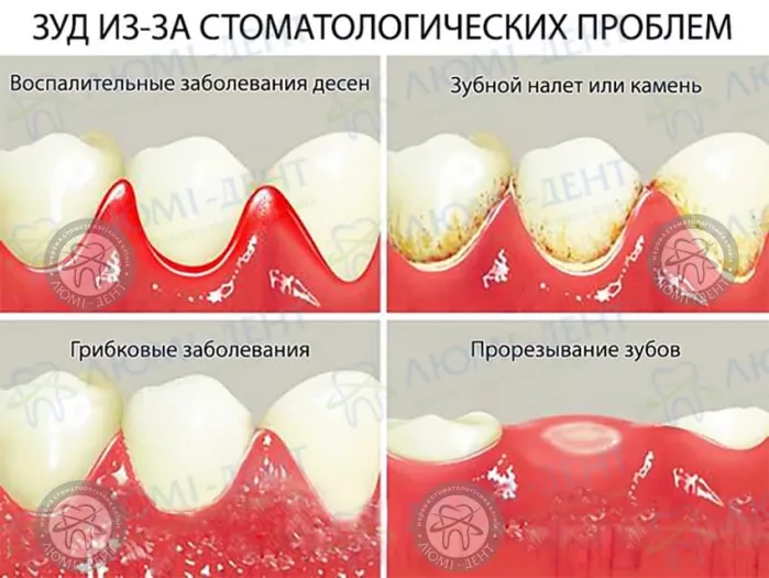 Зуд из-за стоматологических проблем Чешутся десна фото ЛюмиДент
