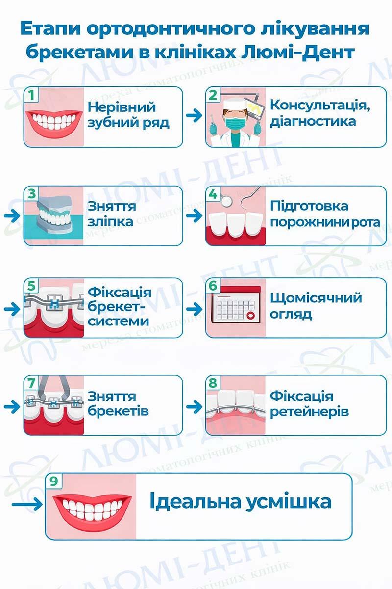 Етапи ортодонтичного лікування брекетами