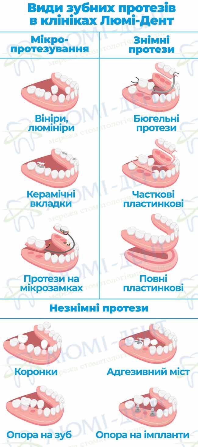 Бюгельні протези це фото Люмі-Дент