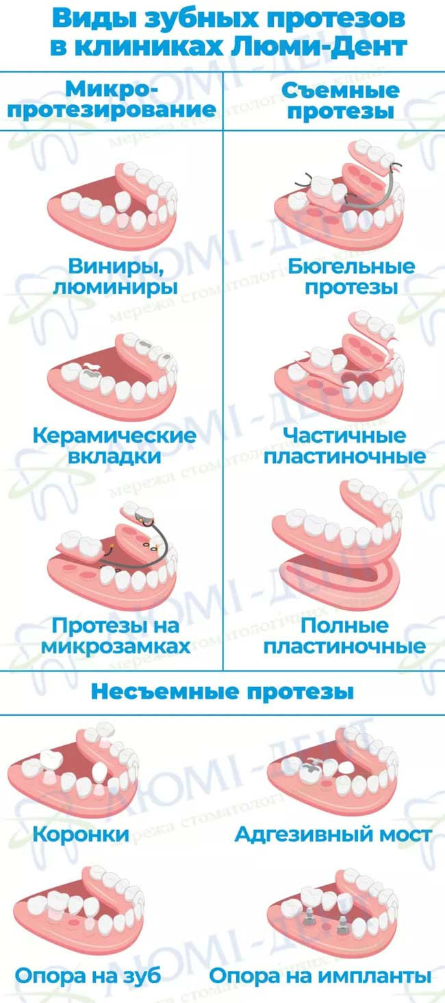 Полный зубной протез фото ЛюмиДент