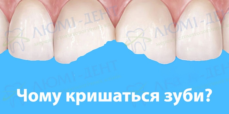 Причини кришення зубів Чому кришаться зуби фото