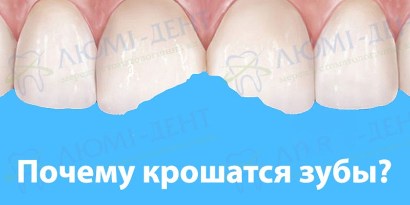 Причины крошения зубов Почему крошатся зубы фото