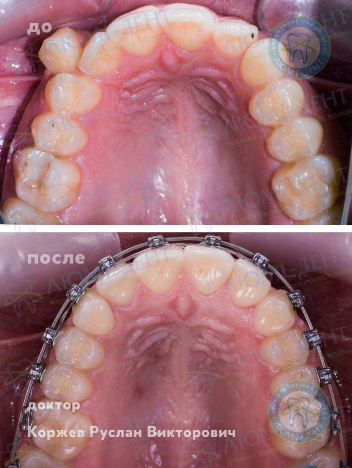 Лікар-ортодонт що лікує фото Люмі-Дент