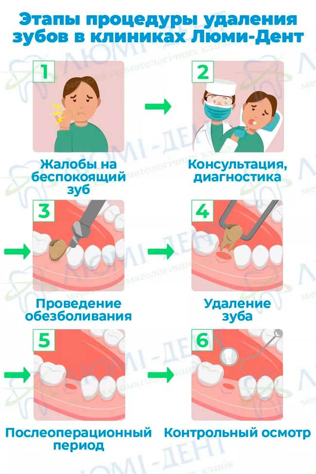 Что делает стоматолог хирург фото ЛюмиДент