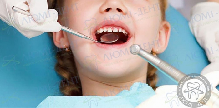 Чи варто лікувати молочні зуби фото Люмі-Дент