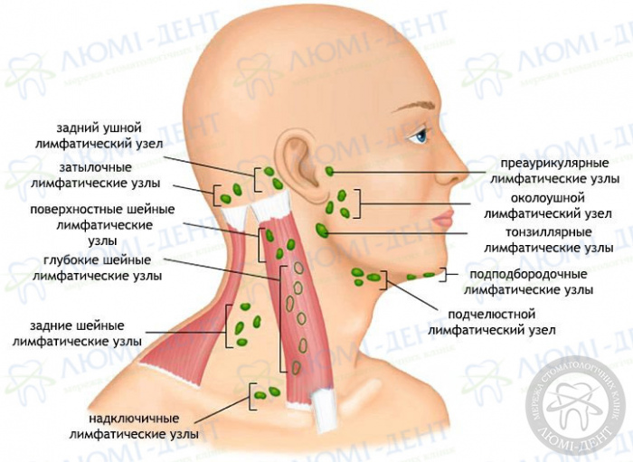 Болит лимфоузел под челюстью фото Люми-Дент