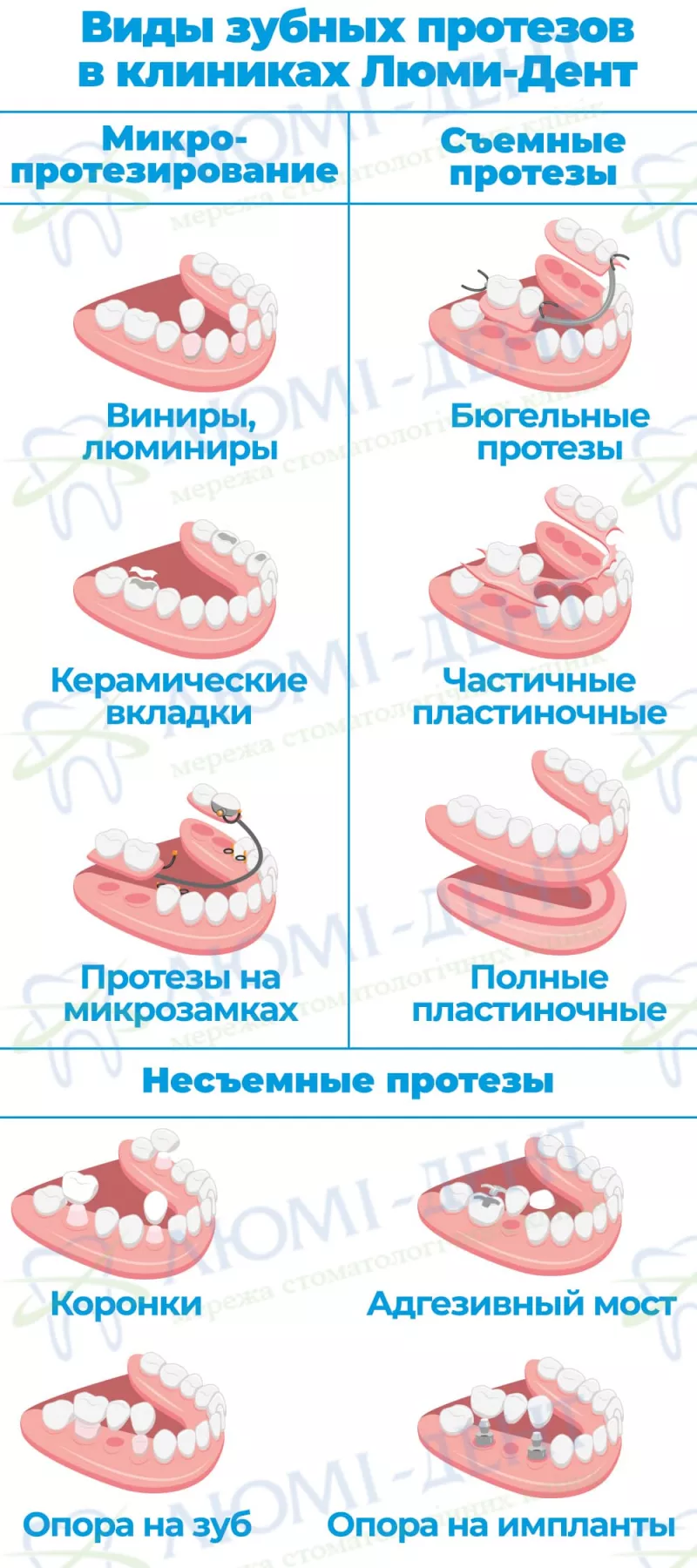 Виды протезов Выпала коронка чем приклеить фото ЛюмиДент