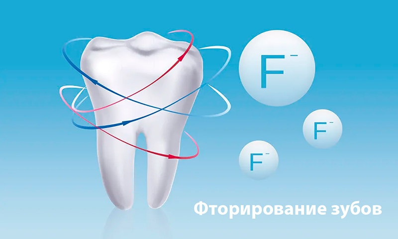 Фторирование зубов фото Люми-Дент