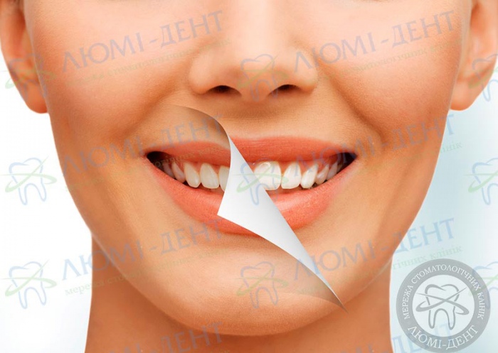 Полоскання зубів содою фото Люмі-Дент