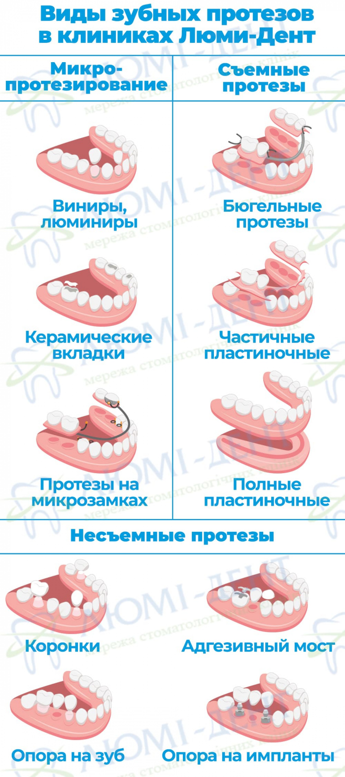 Протезирование зубов протезы фото Люми-Дент