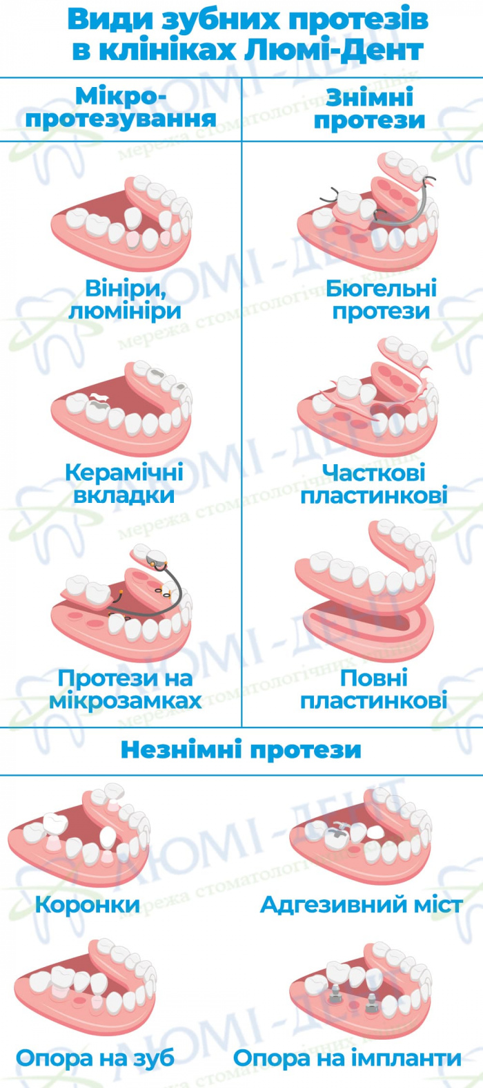 Протезування зубів протези фото ЛюміДент