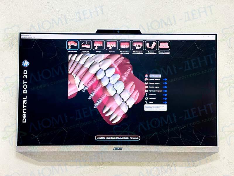 Віртуальний консультант Dental Bot 3D Віртуальний консультант Dental Bot 3D Люмі-Дент