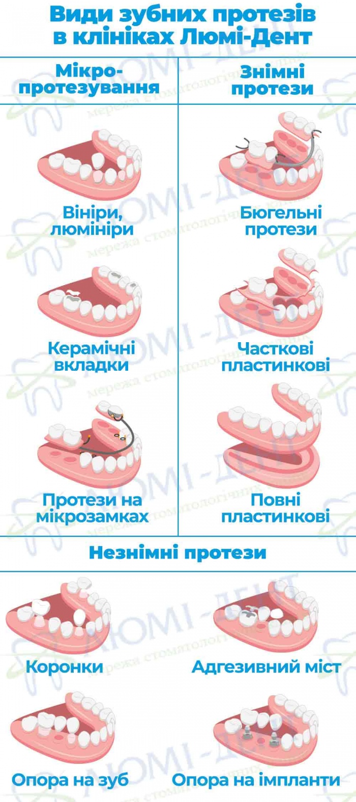 Протезування при повній відсутності зубів фото Люмі-Дент