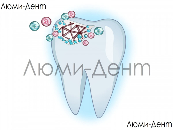 Зміцнення лікування імплантація емалі зубів Люмі-Дент