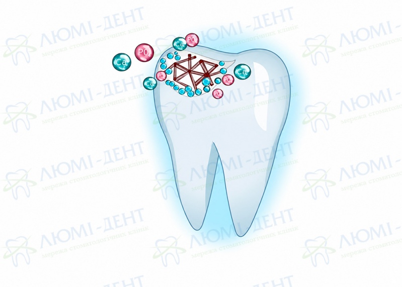Методика восстановления эмали зубов Icon Укрепление лечение имплантация эмали зубов фото Люми-Дент