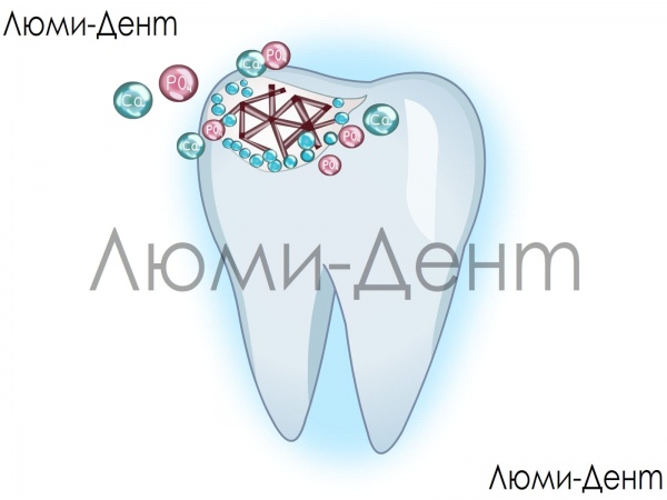 Укрепление лечение имплантация эмали зубов фото Люми-Дент