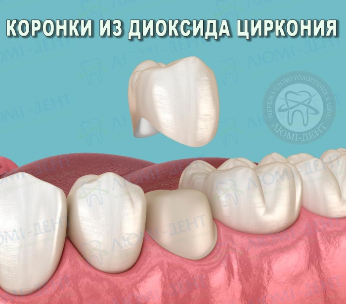 циркониевая коронка фото Люми-Дент