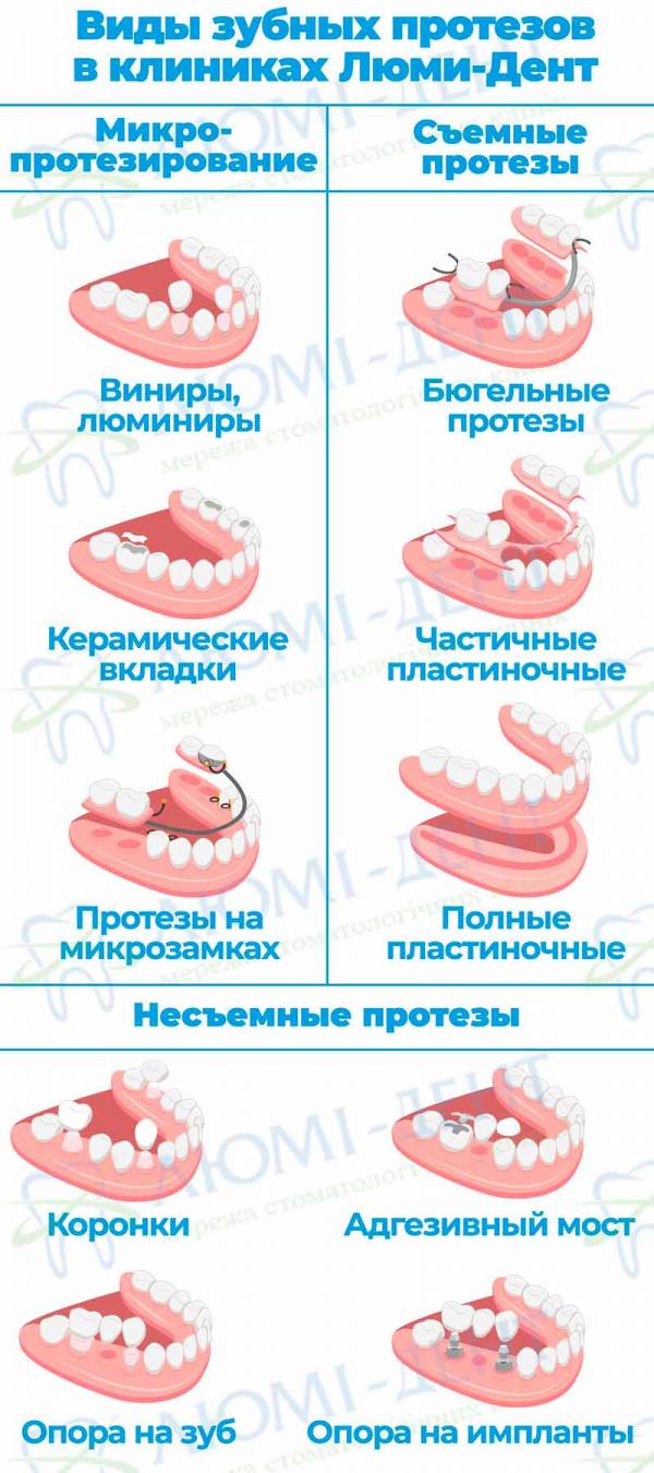 Виды зубных протезов циркониевые коронки минусы фото Люми-Дент