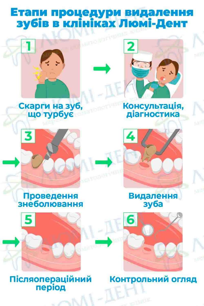 Етапи видалення зубів Ускладнення після видалення зуба мудрості фото ЛюміДент