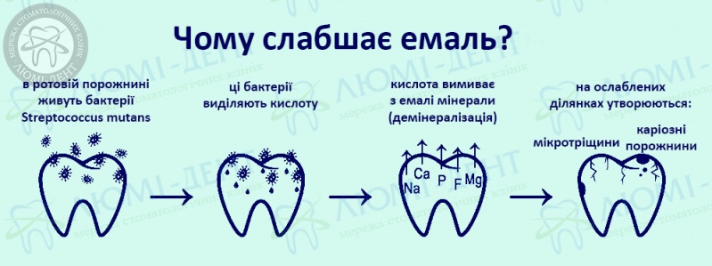 ремінералізація емалі фото Люмі-Дент