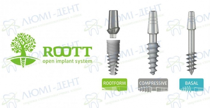 Виды имплантатов Roott Виды имплантатов Roott