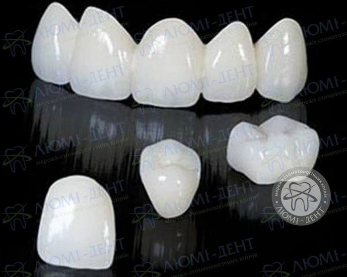 Тремя щілина між передніми зубами фото Люмі-Дент