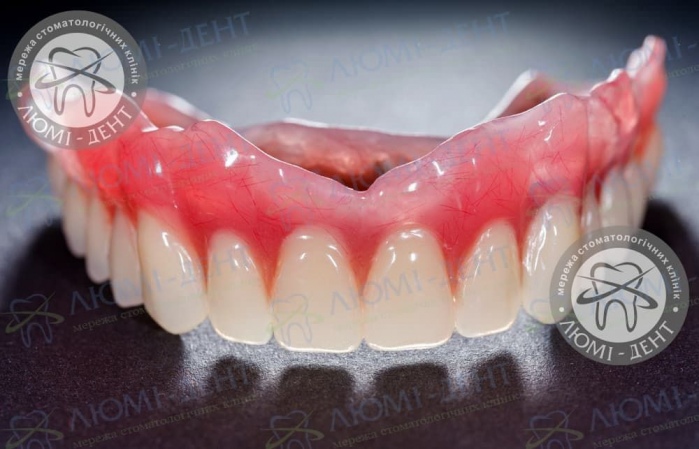 Съемное протезирование зубов протезы фото Люми-Дент