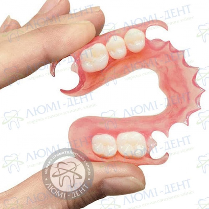 Знімне протезування зубів протези фото Люмі-Дент