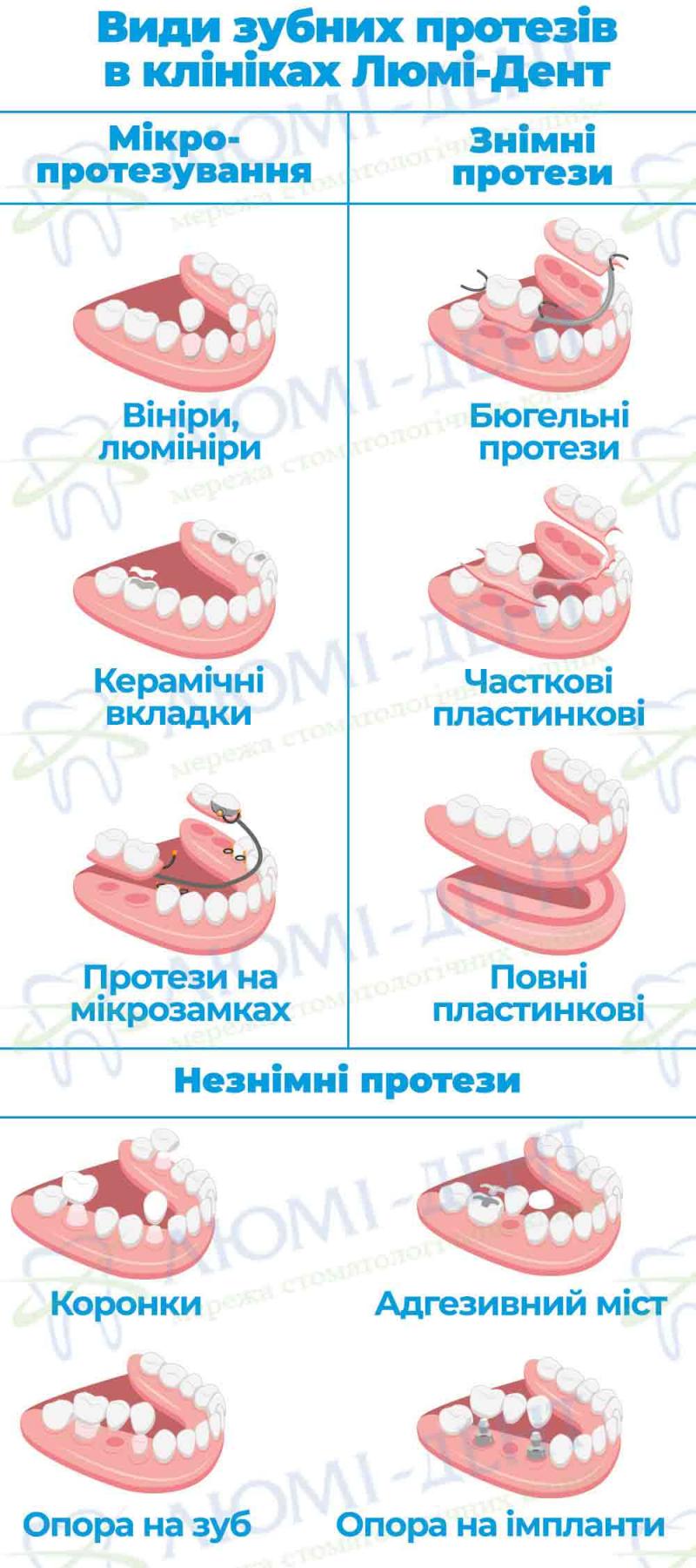 Види протезів зубів Знімні зубні протези фото Люмі-Дент
