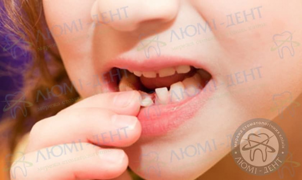 Хитаються нижні зуби у дитини фото люмідент